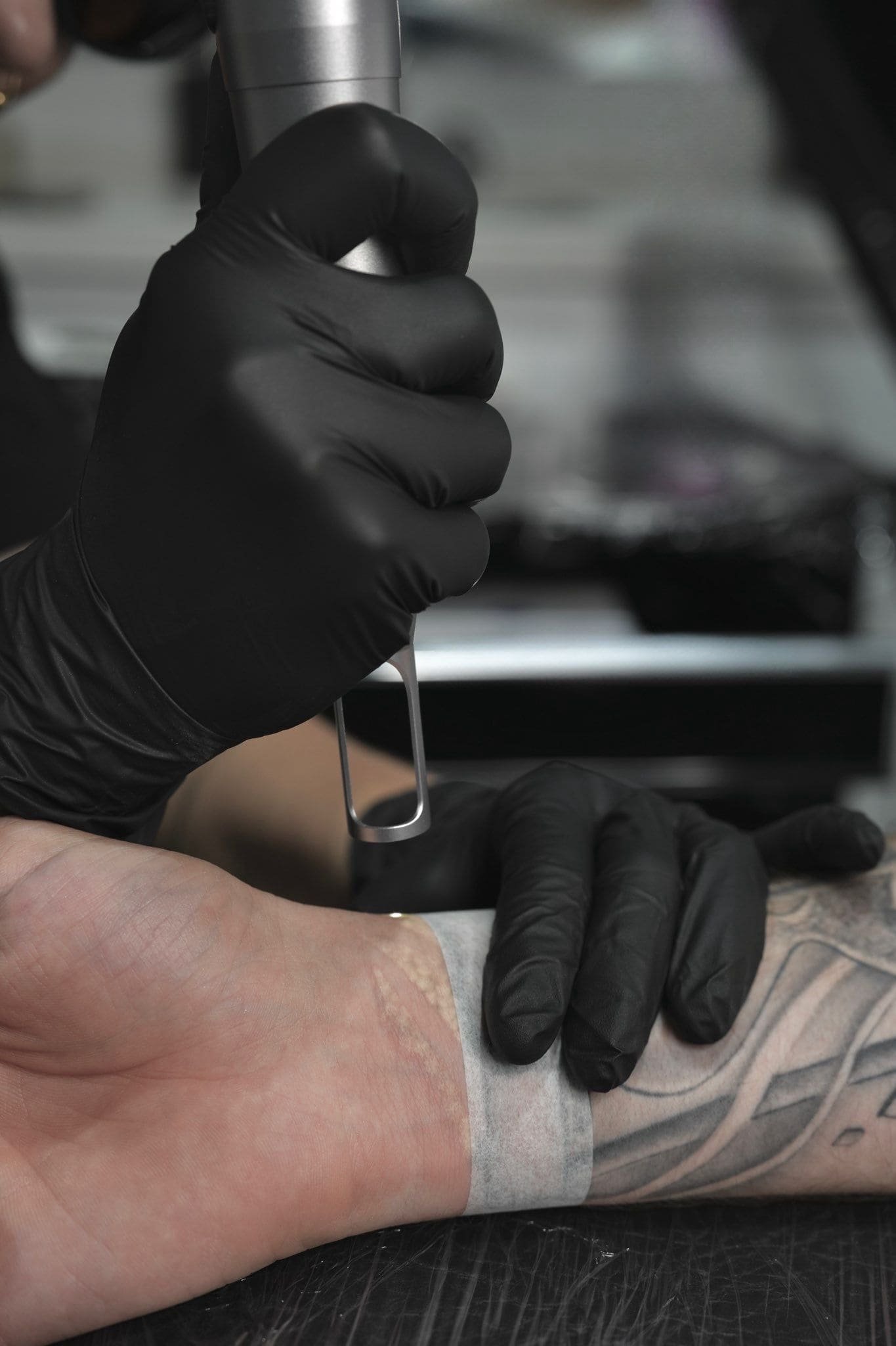 ¿Cómo se elimina un tatuaje con láser? Todo lo que necesitas saber antes de dar el paso
