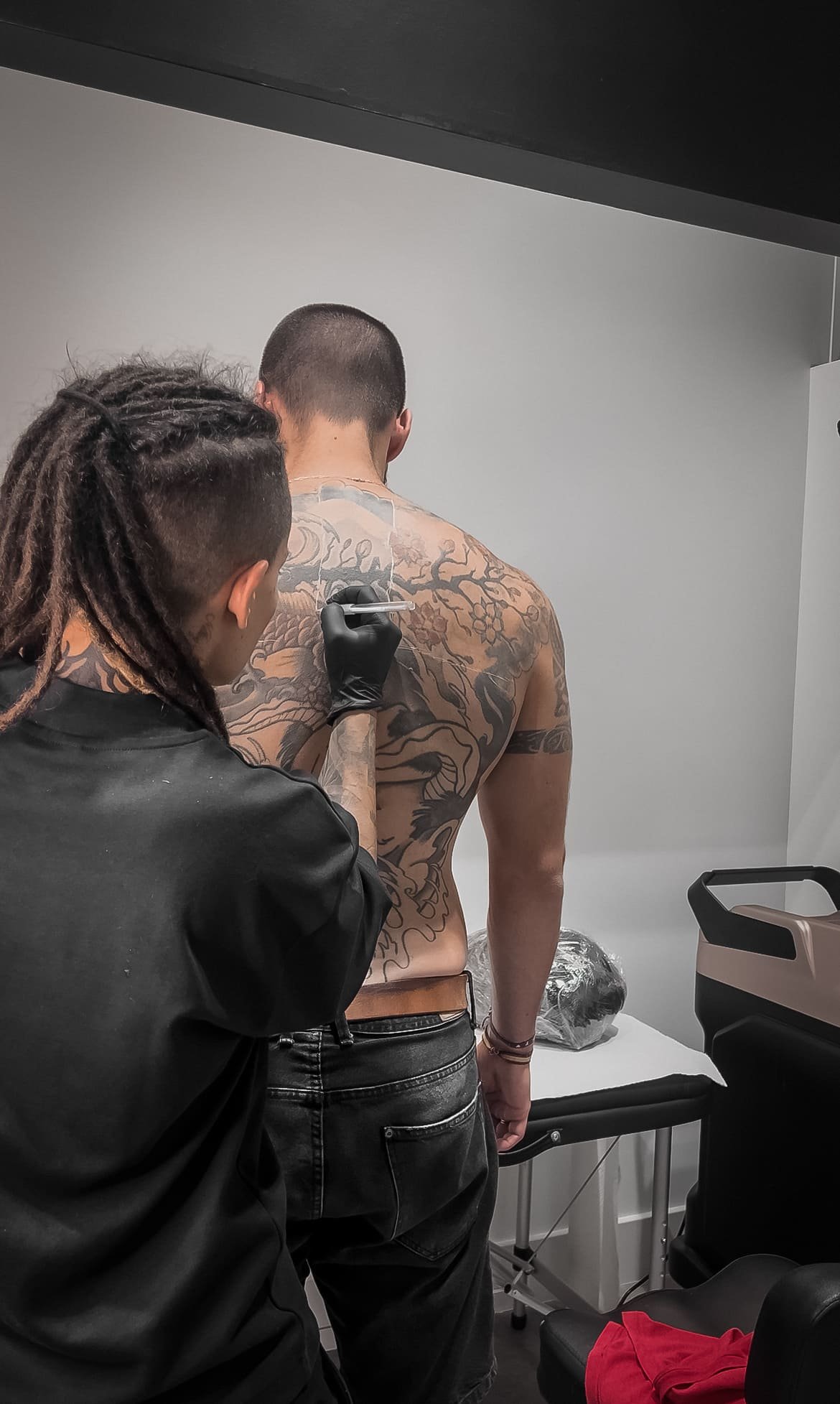 ¿Hay zonas del cuerpo donde cuesta más eliminar un tatuaje?