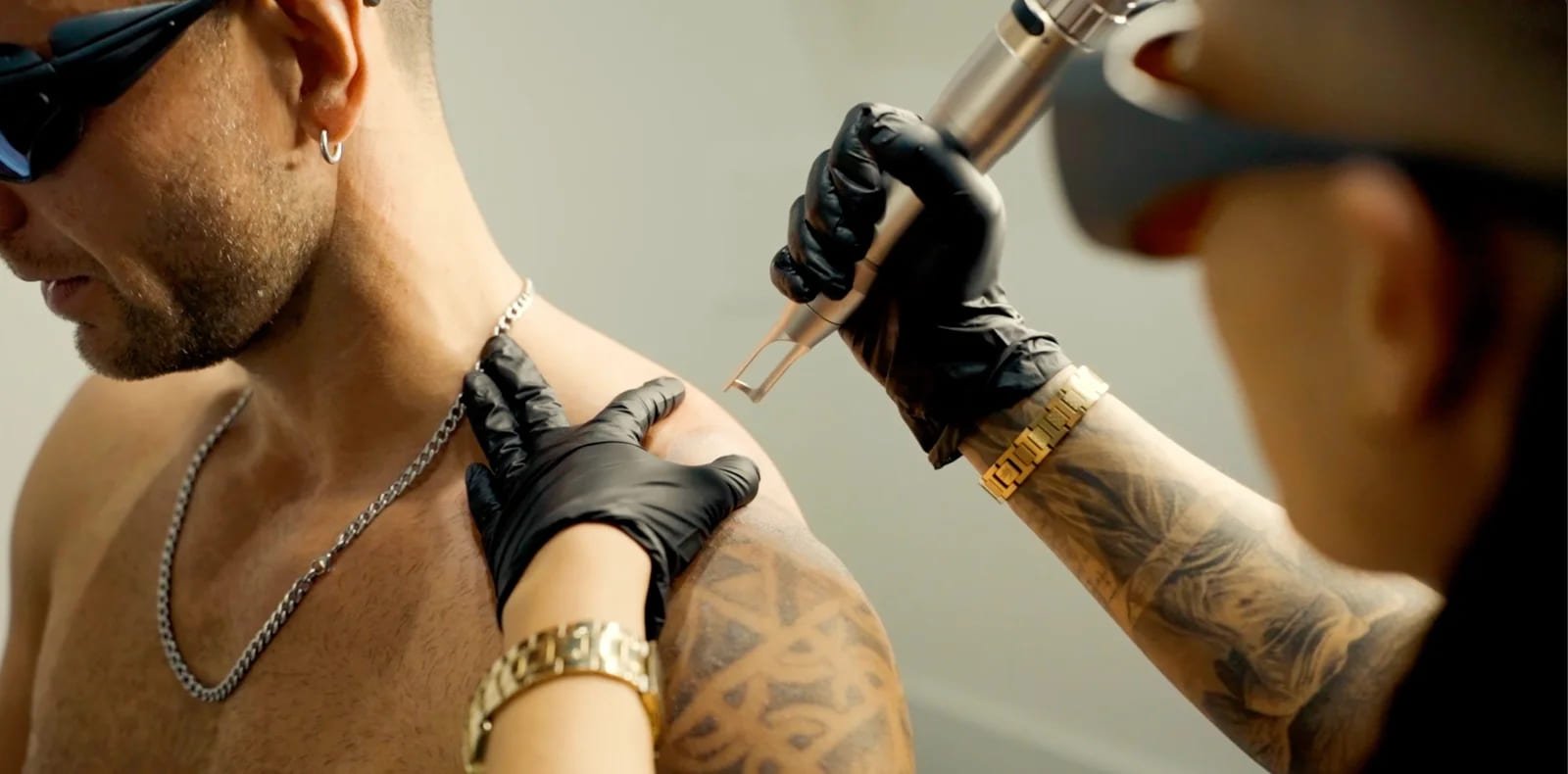 Marina eliminando un tatuaje negro en el hombro de un cliente