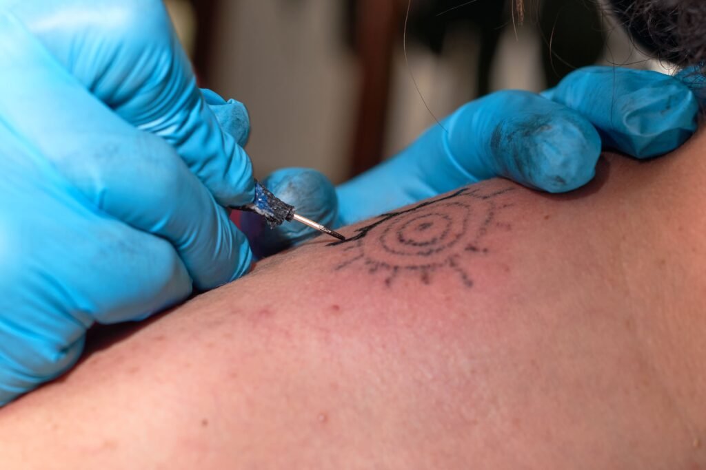cuándo eliminar un tatuaje nuevo 