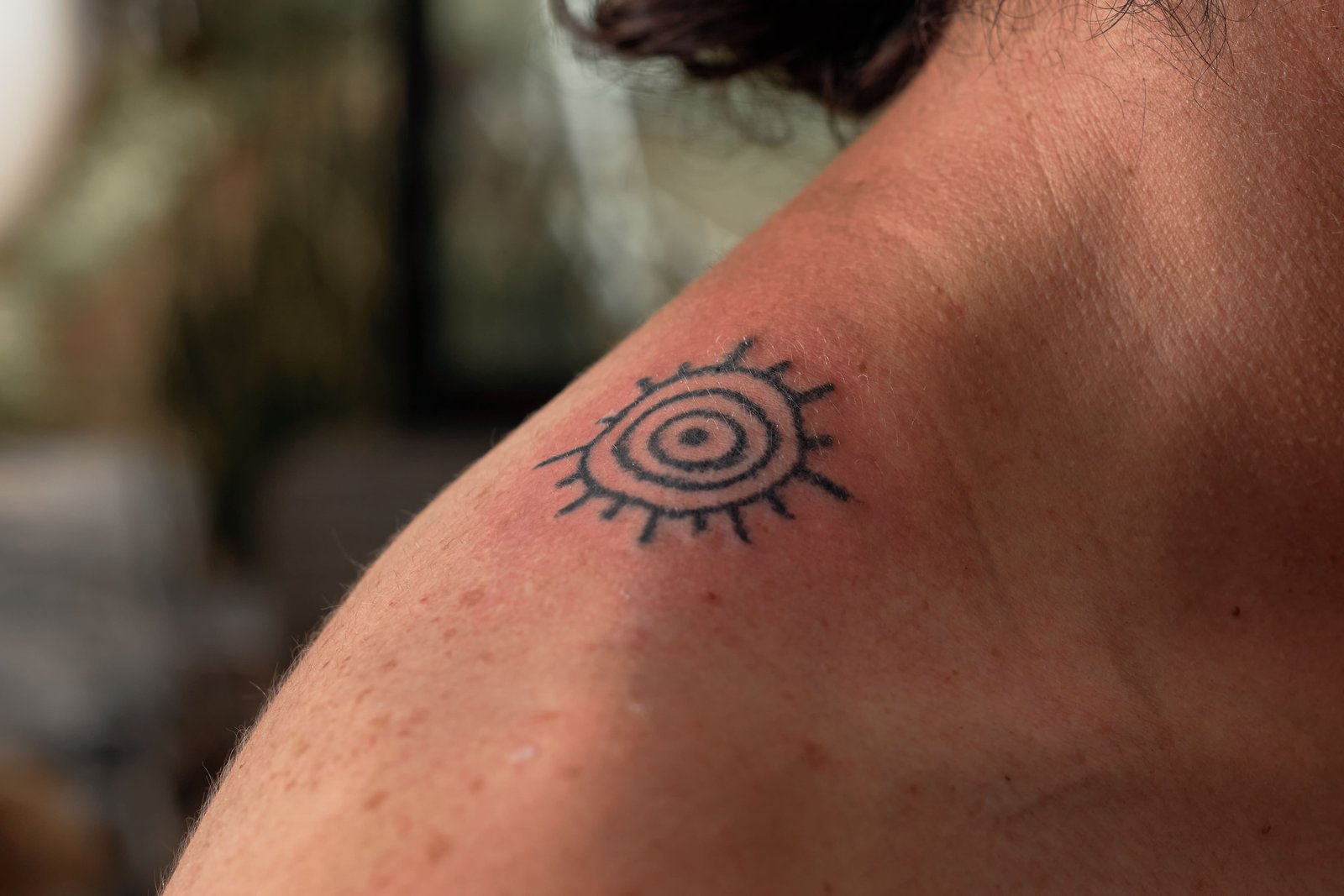 ¿Puedo eliminar un tatuaje reciente o tengo que esperar? Riesgos y tiempos recomendados