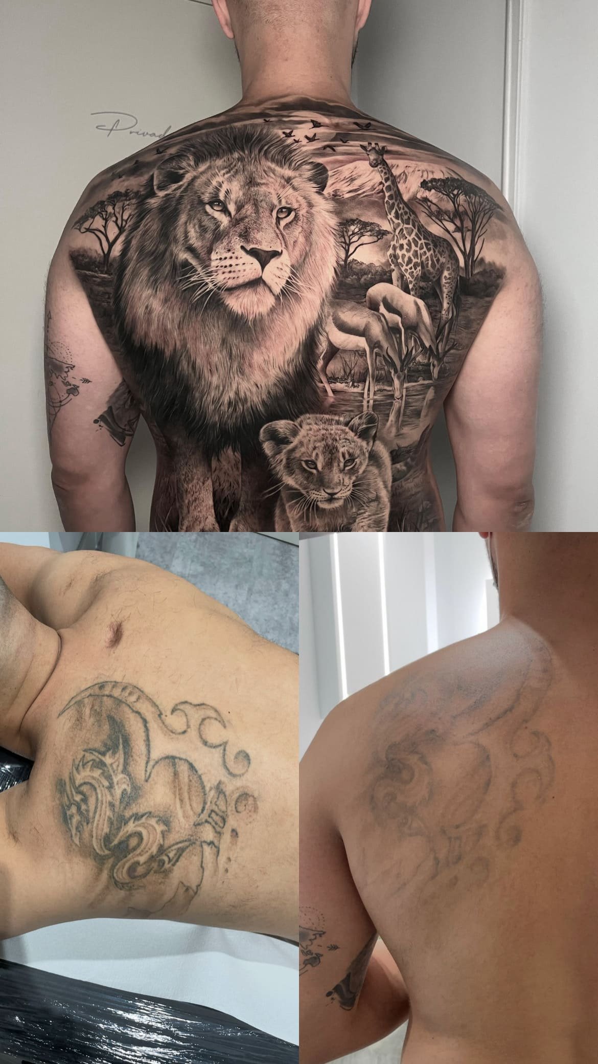 Tengo un tatuaje antiguo. ¿Puedo eliminar parte de la tinta y posteriormente hacer otro proyecto encima?