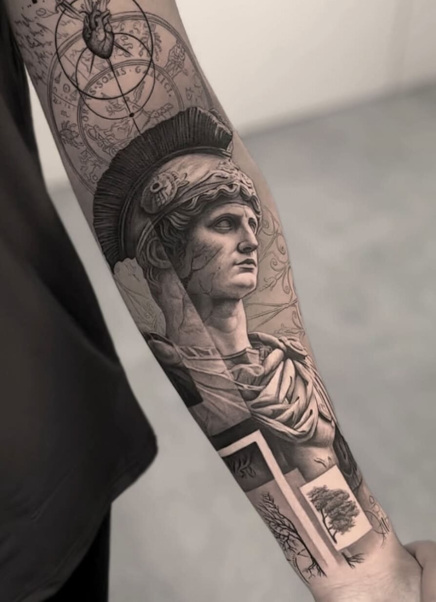 eliminacion-de-tatuajes