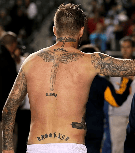 Eliminación de tatuajes antiguos: cuando las modas pasan y el cuerpo cambia