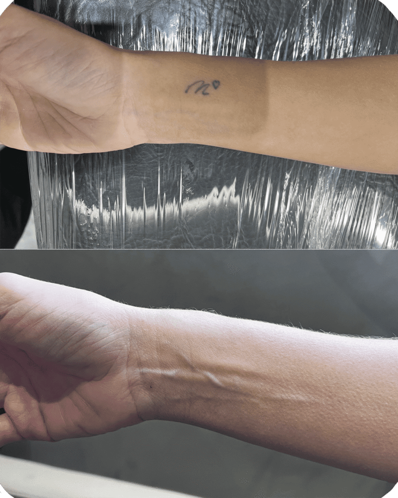 casos de exito 4 yentl