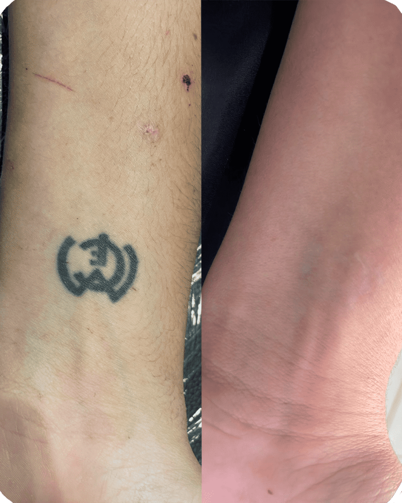 casos de exito silvia